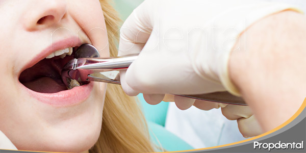 La-técnica-de-exodoncia-en-dentición-temporal