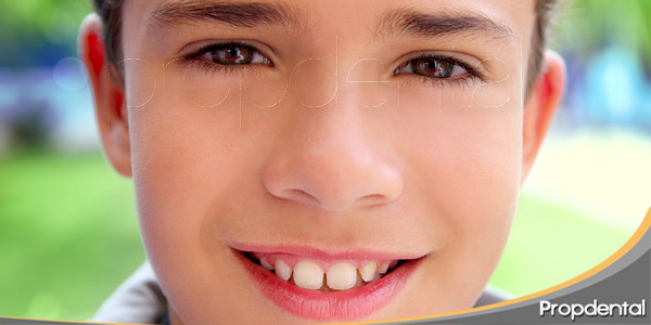 problemas-dentales-en-la-adolescencia