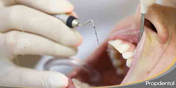 La-peridoncia-dental
