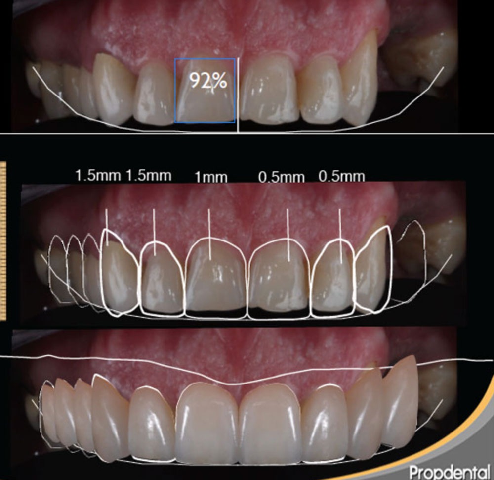 especialistas en estética dental