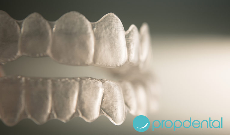 Ortodoncia: Alternativas a los brackets tradicionales