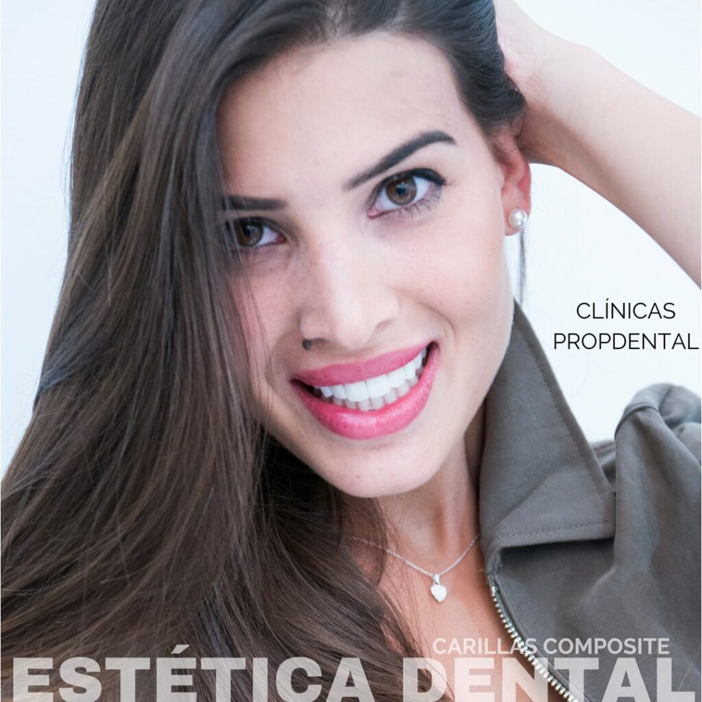 carillas composite estética dental