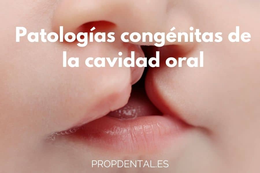patologias congénitas de la cavidad oral