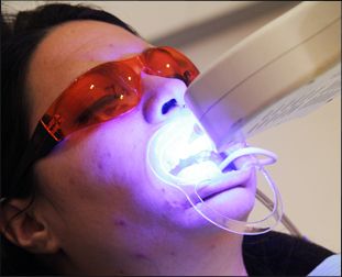 precio blanqueamiento dental