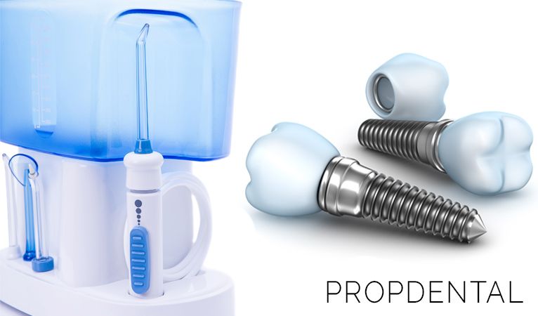 Limpieza de los implantes dentales