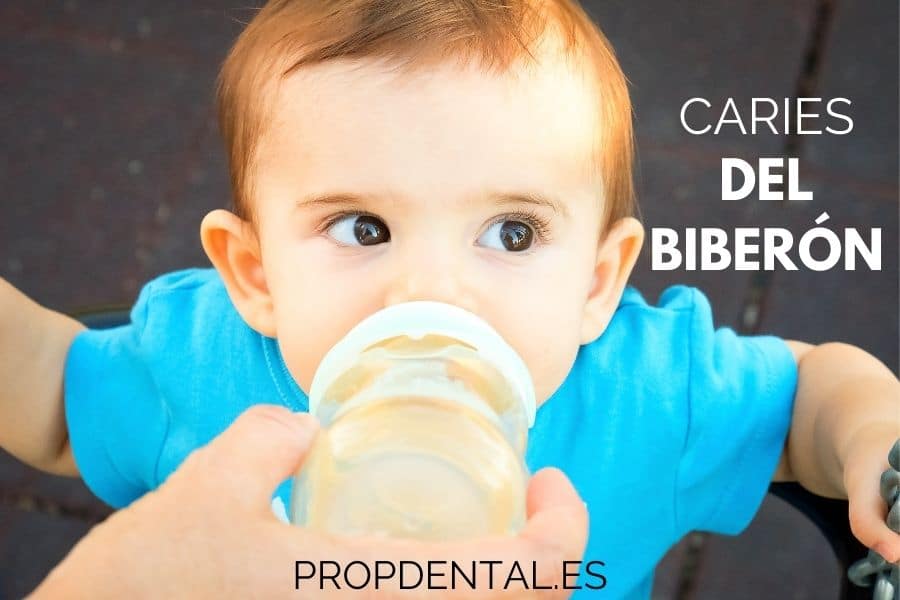 caries del biberón