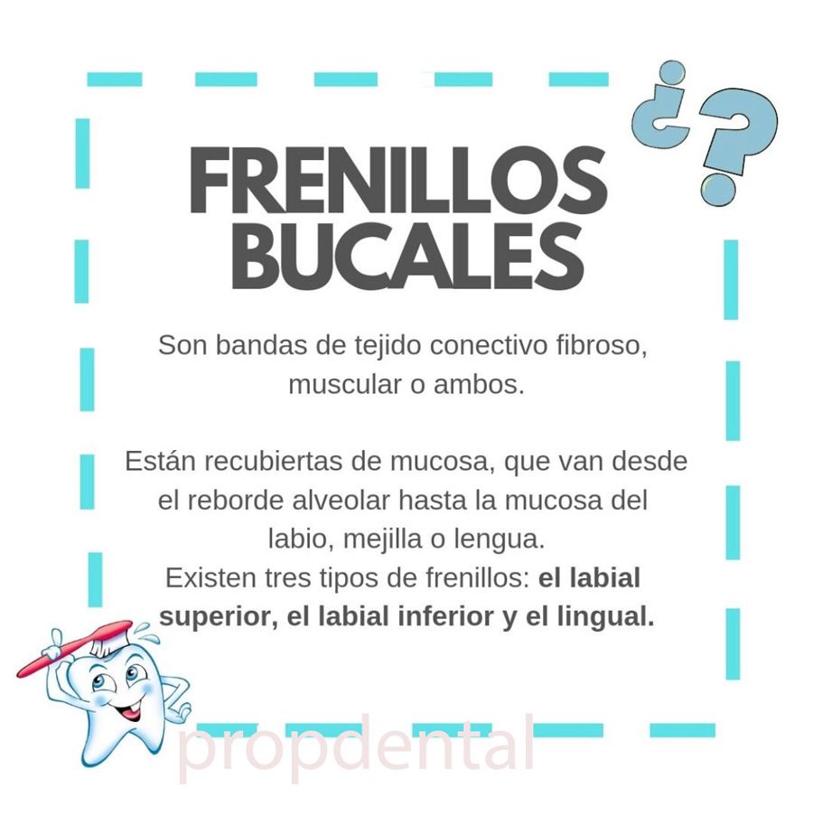 ¿Que son los frenillos bucales?