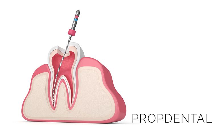 hay dolor después de una endodoncia
