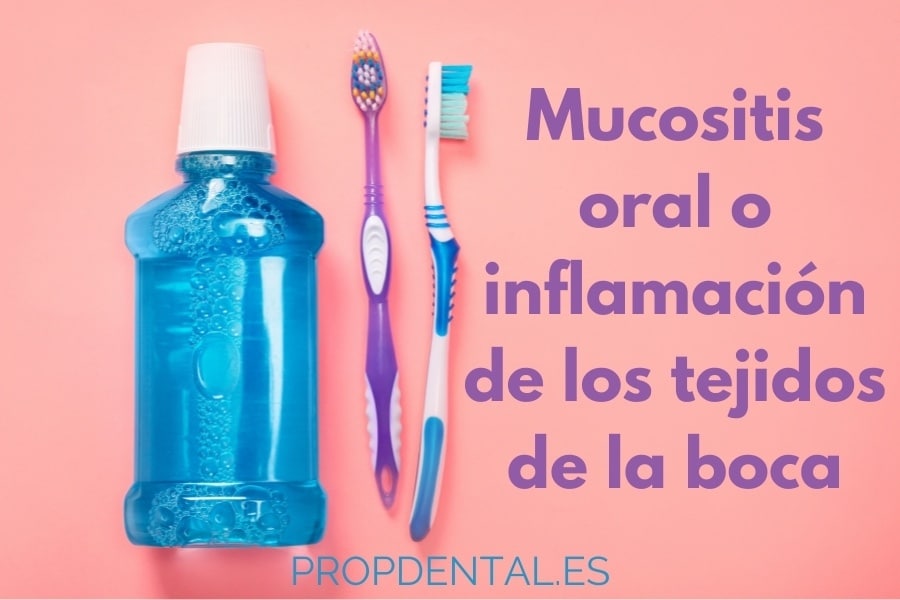 mucositis oral o inflamación de los tejidos de la boca