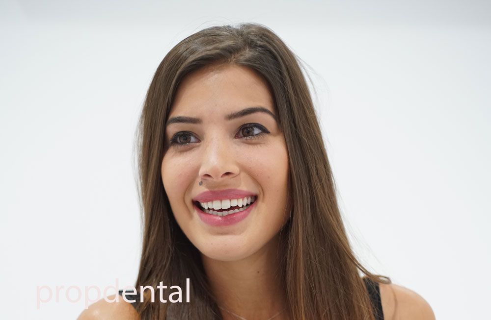 porque se mueven los dientes
