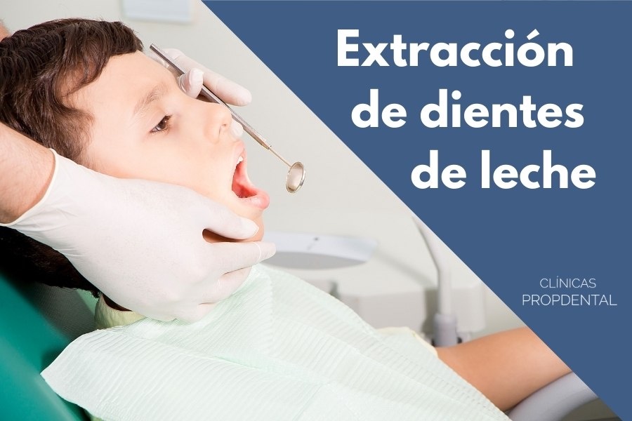 Extracción de dientes de leche