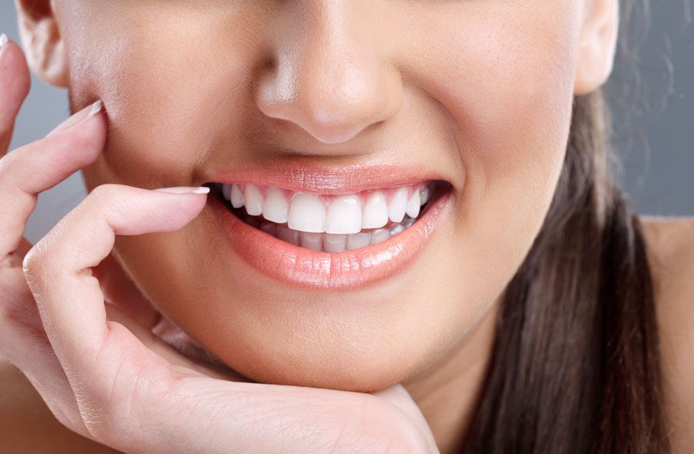 Beneficios de las Carillas Dentales para lucir una bella sonrisa