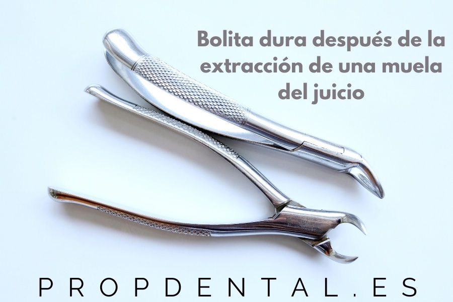 Bolita dura después de la extracción de una muela del juicio