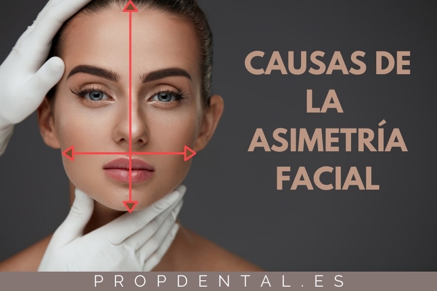 causas de la asimetria facial