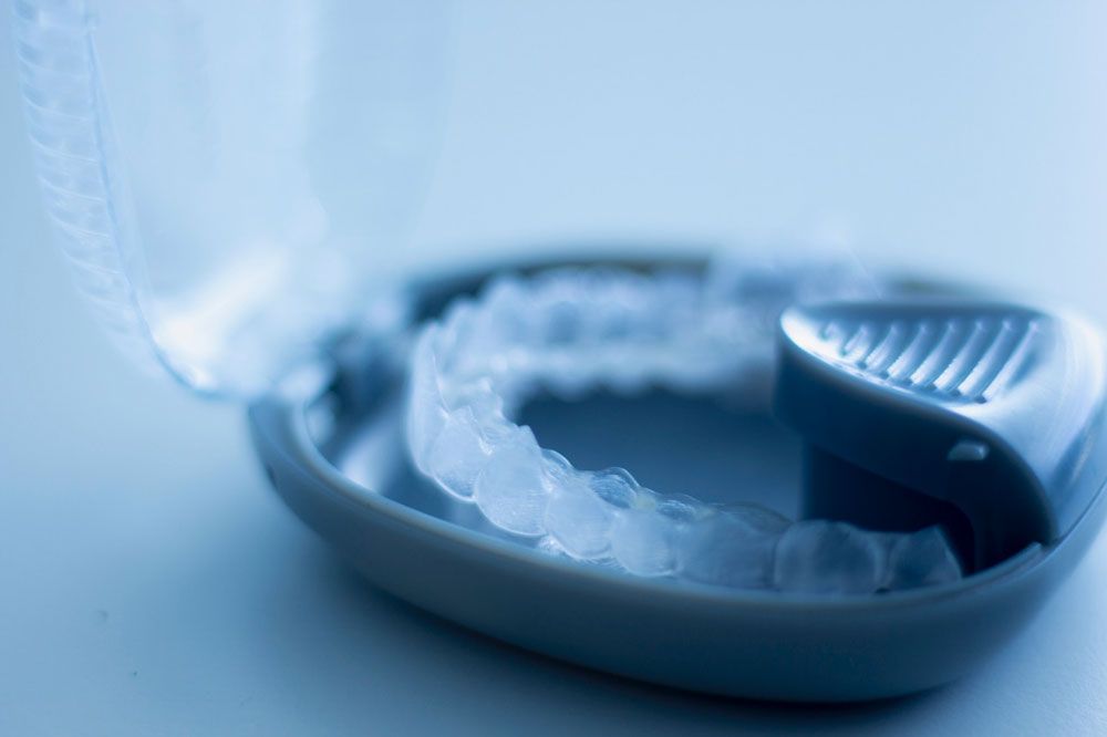 Cómo limpiar férulas invisalign