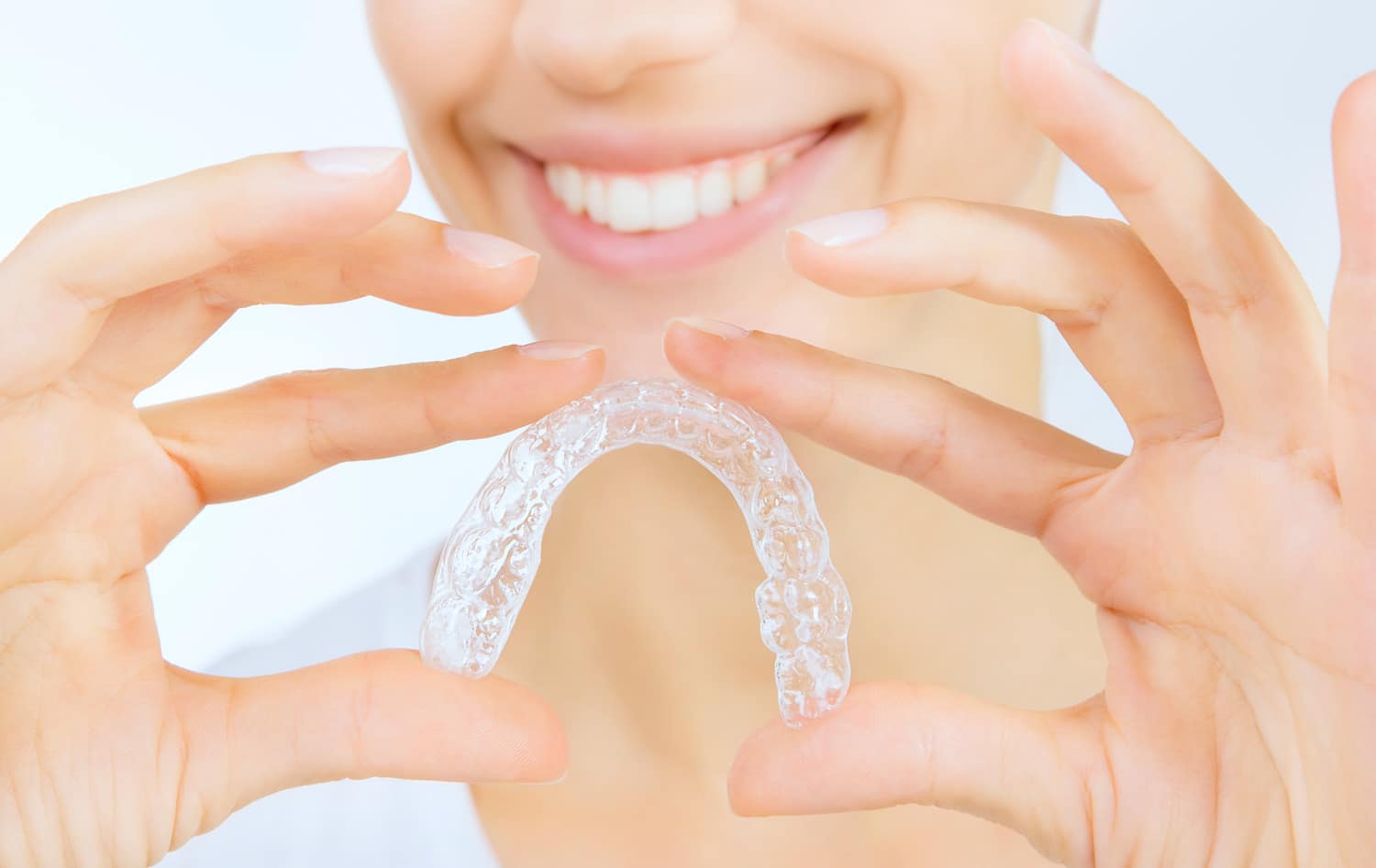 paso a paso invisalign