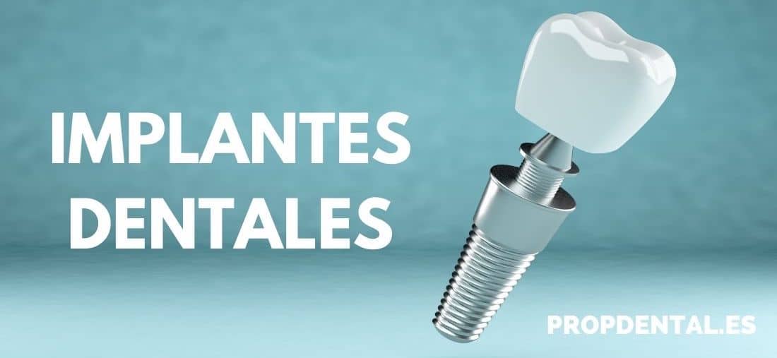 Presupuesto de implantes dentales en Propdental