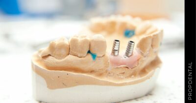 Transposición del nervio dentario inferior