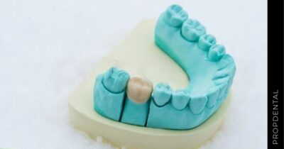 Cuidar las coronas dentales