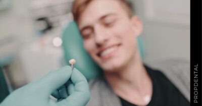 ¿Cuál es la edad mínima para colocar un implante dental?