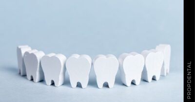 Indicaciones de las incrustaciones dentales