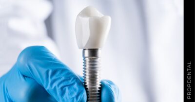 Marcas de implantes dentales