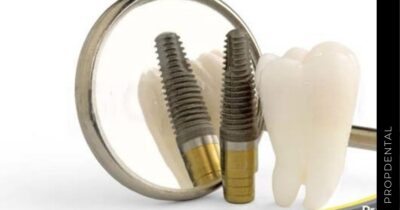 Extracción dental e inserción de implante
