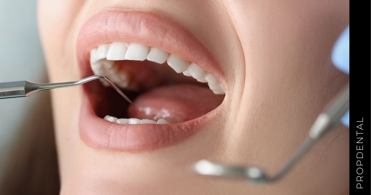 Anatomía de la cavidad oral