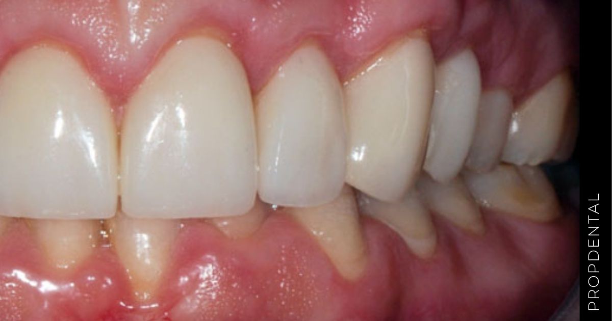 Casos clínicos estética dental