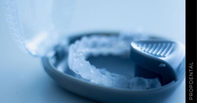 ¿Cómo limpiar invisalign?