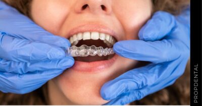 Cuánto tiempo dura el tratamiento Invisalign?