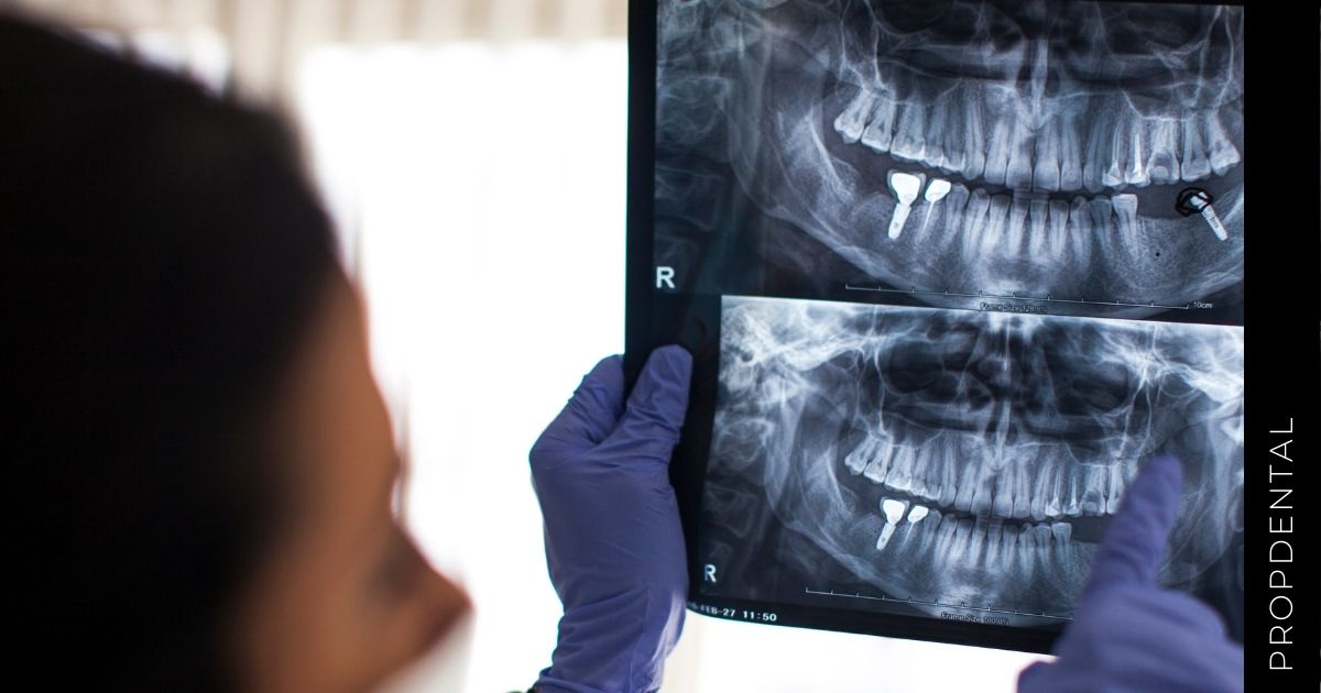 Diagnóstico radiológico de las anomalías dentarias
