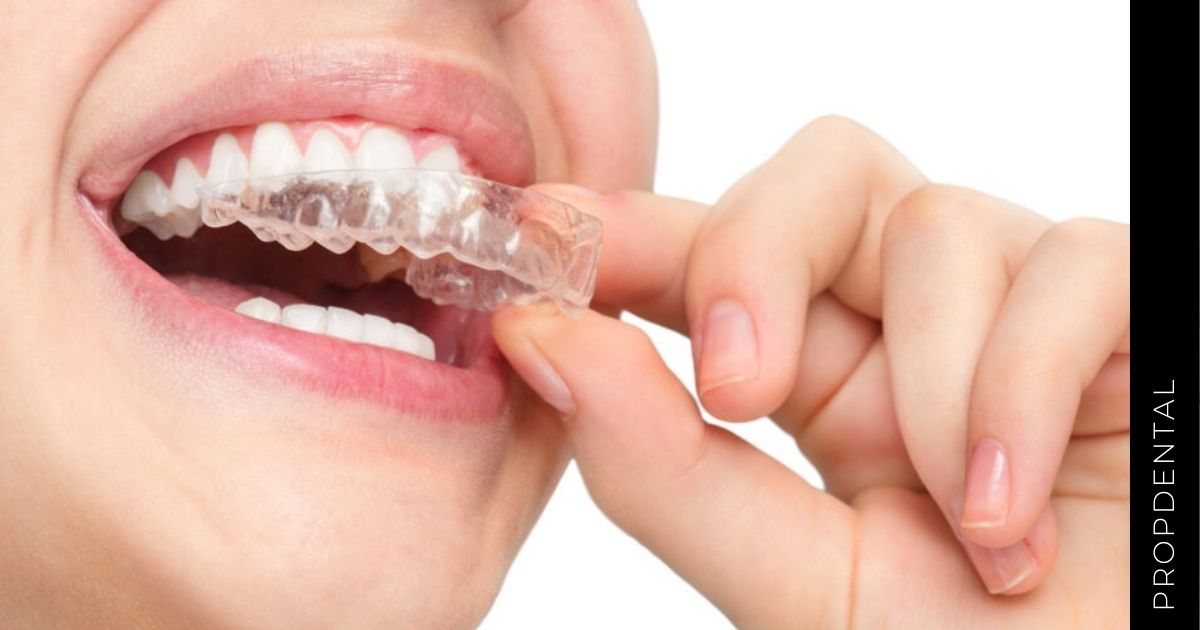 Efectos secundarios invisalign