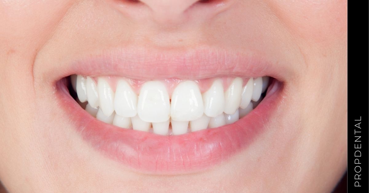 Especialistas en sonrisas: Los higienistas dentales