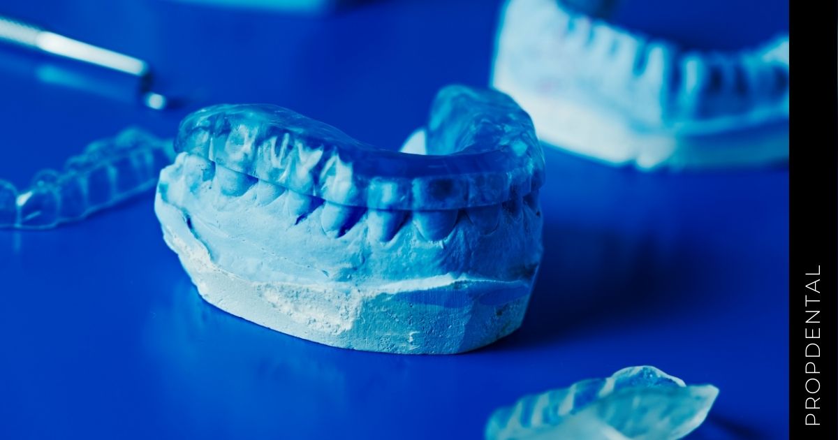 Fundas dentales: Tipos y función