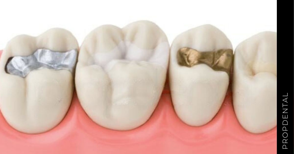 La adaptación a las restauraciones dentales