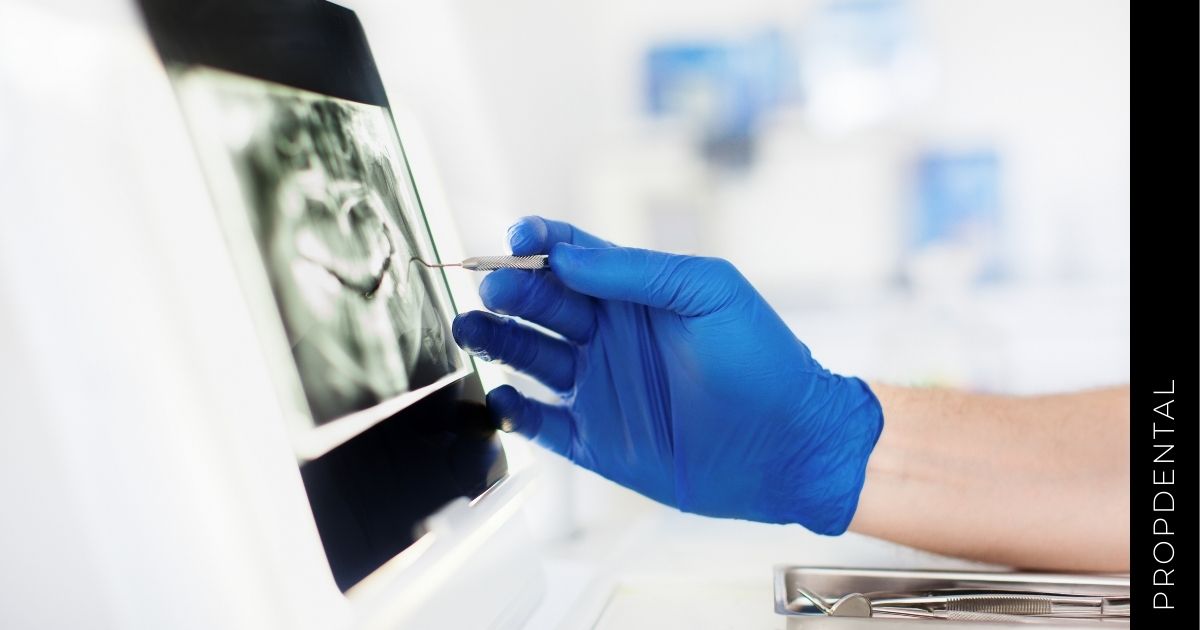 La importancia de las radiografías en Odontología