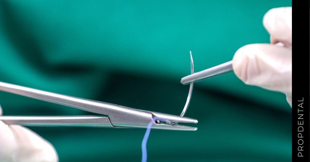 La sutura en cirugía bucal