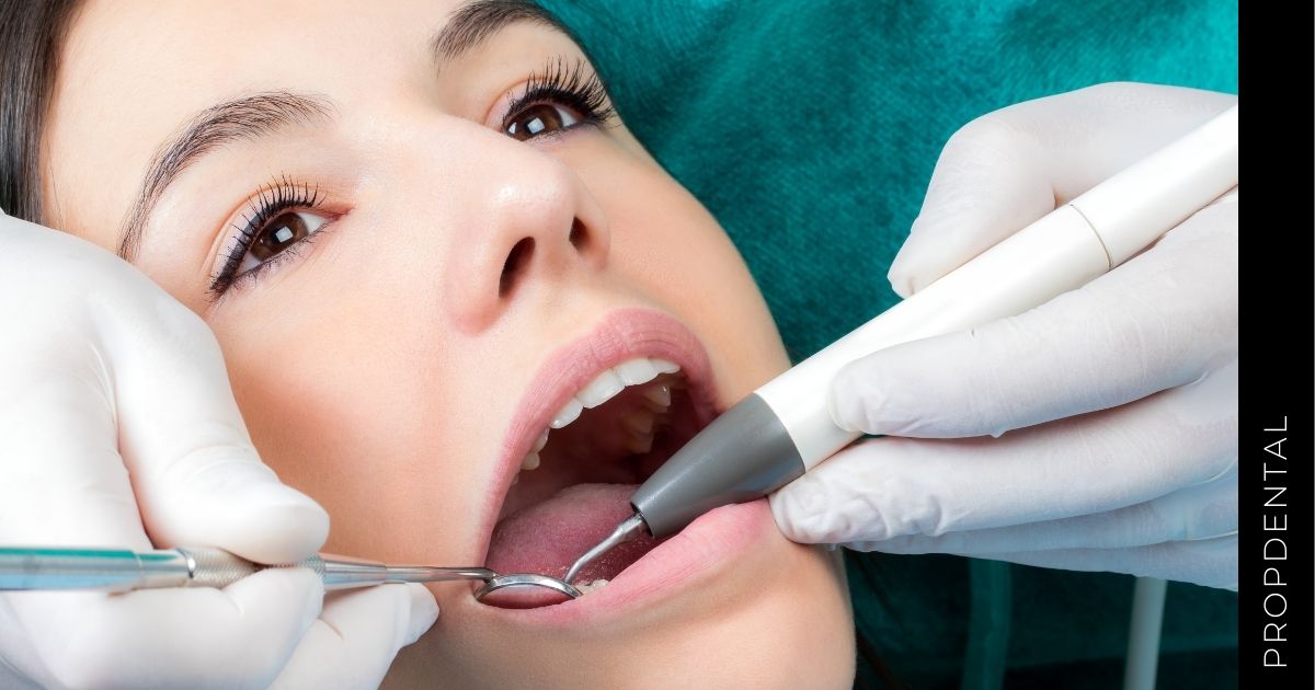 Limpieza dental ultrasónica