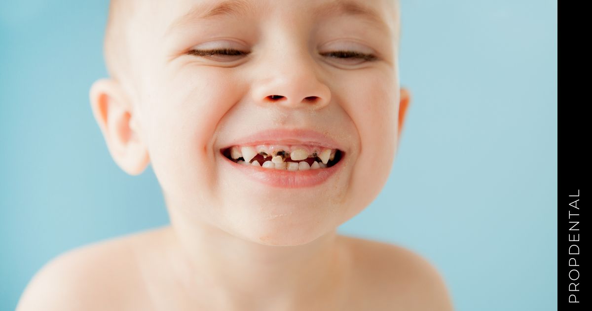 Los dientes negros en los niños