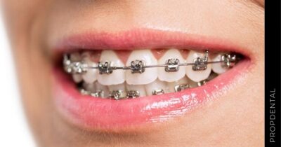Ortodoncia e implantes dentales