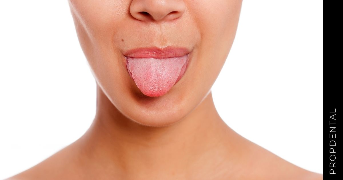 Patologías de la lengua