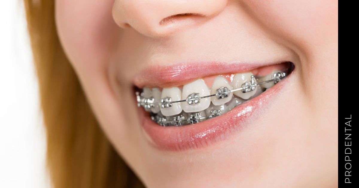 ¿Qué complicaciones tiene el Apiñamiento dental?