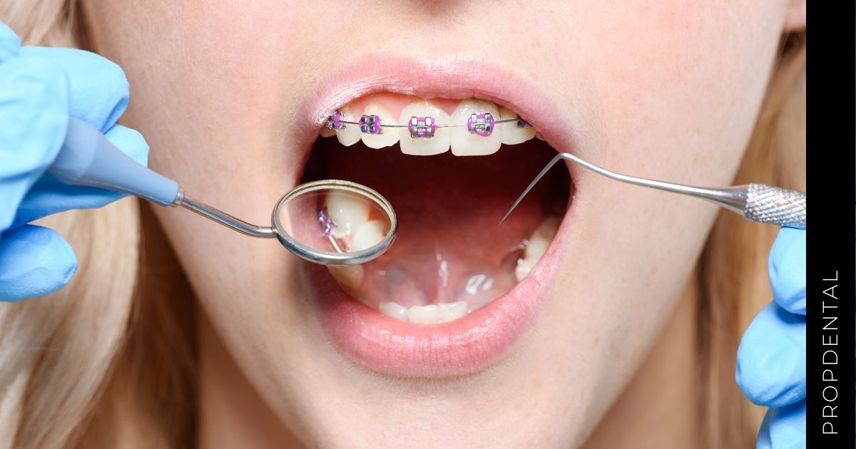 Relación entre periodoncia y ortodoncia