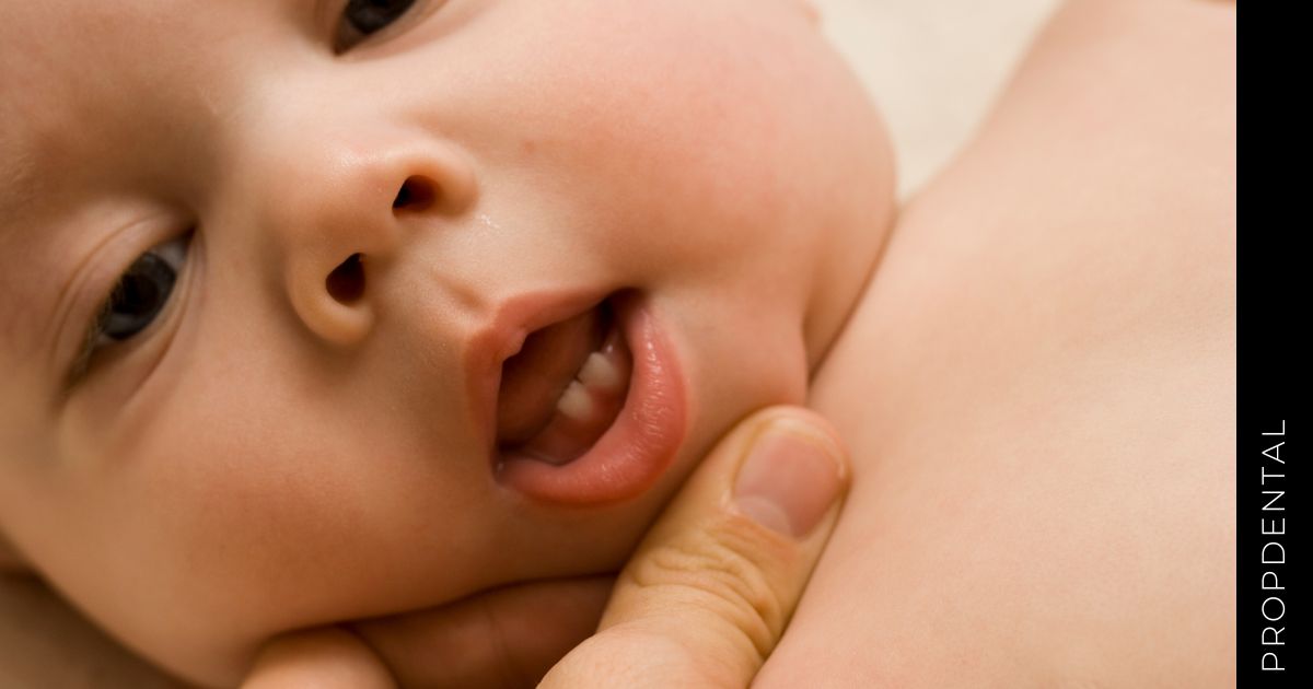 Retraso erupción de los dientes de leche