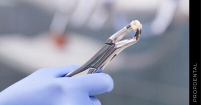 Tipos de extracciones dentales