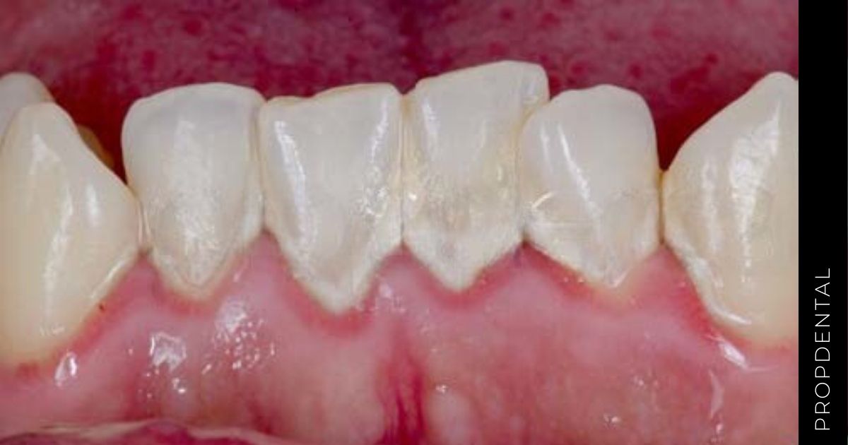 Sarro dental