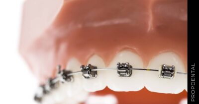 Alambre de ortodoncia punzante