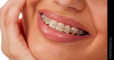 Oclusión en ortodoncia
