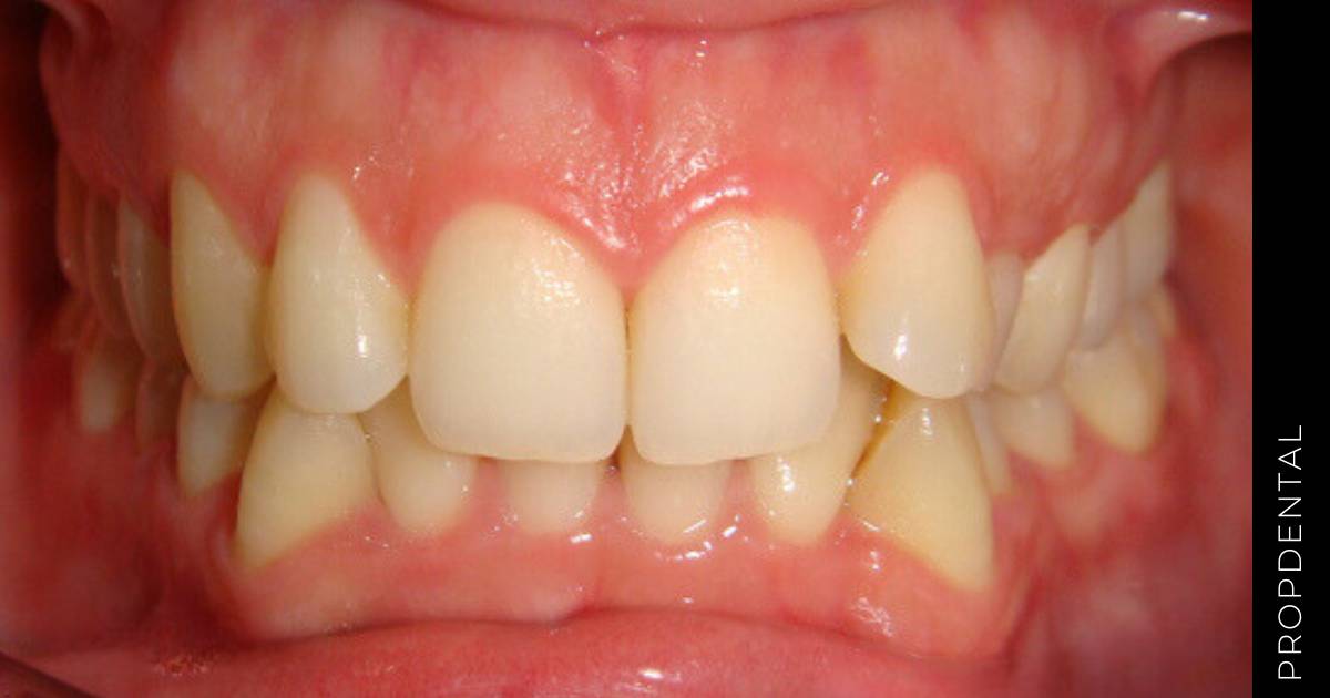 Caso clínico de ortodoncia